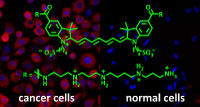 The fluorescent probe PATTI-781 (green) stains cancer cells (left side, red), but not healthy cells (right side). All cells are visualised by blue-stained nuclei. Fluorescence microscopy images.
